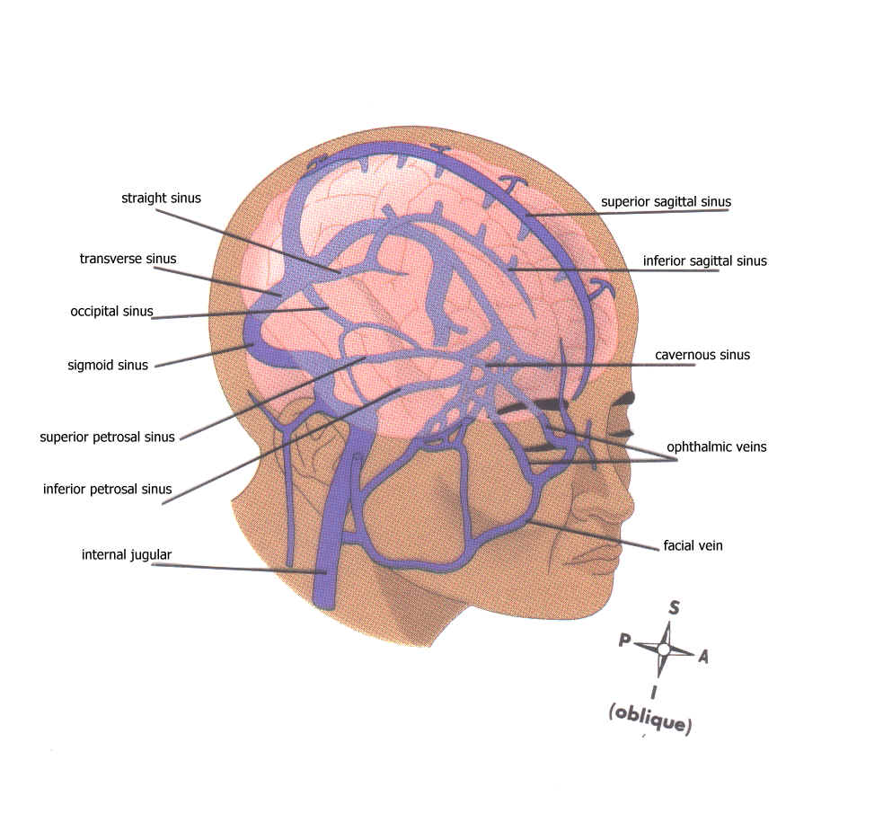 Венозный в черепе. Лобная диплоическая Вена. Диплоические вены анатомия. Лобная диплоическая Вена синус.