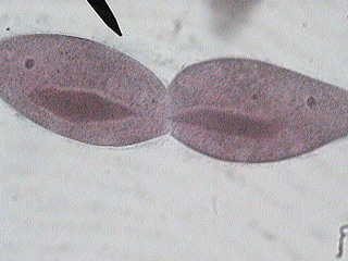 In the reproduction of the paramecium