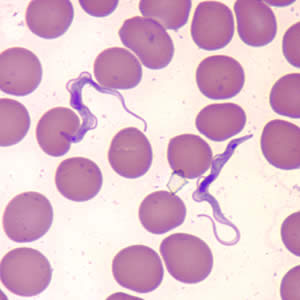 CDC - DPDx - Trypanosomiasis, African