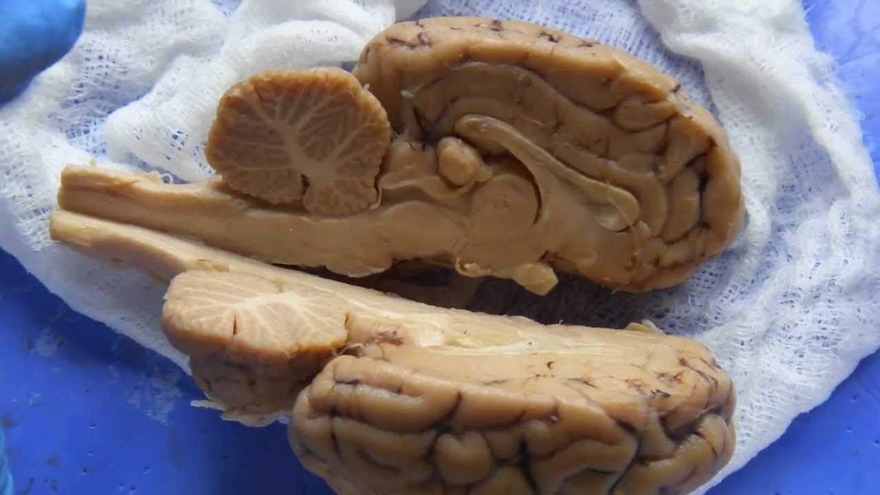 sheep brain sagittal view